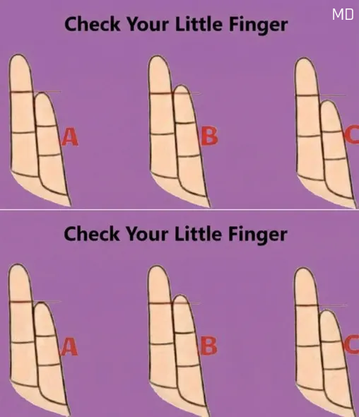 What the Little Finger Symbolizes: A Cultural Look at Personality and Identity