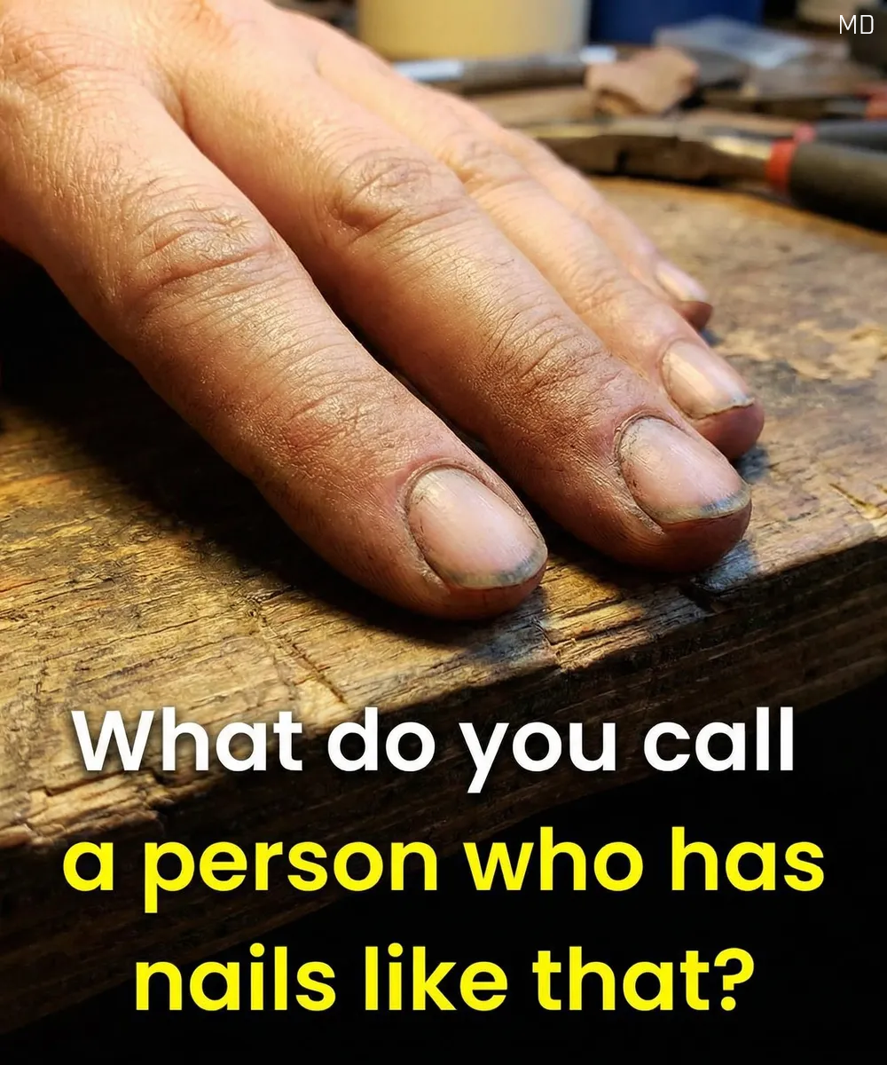 Before You Judge: What Dirty Nails Might Actually Mean