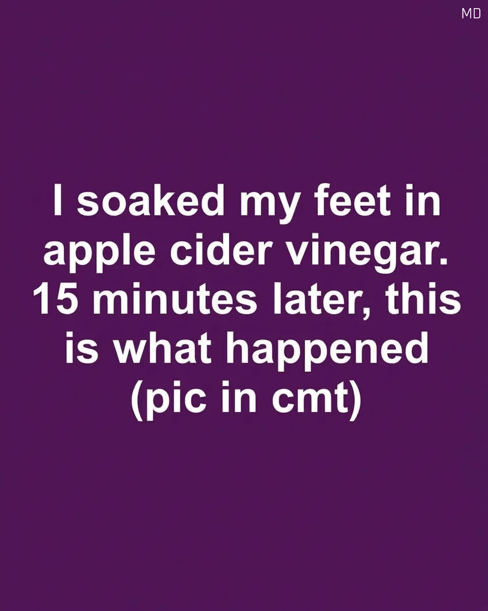 Potential Benefits of Apple Cider Vinegar for Scalp and Skin Care