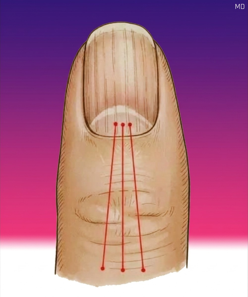 What Vertical Nail Ridges May Indicate and How to Support Nail Health Naturally