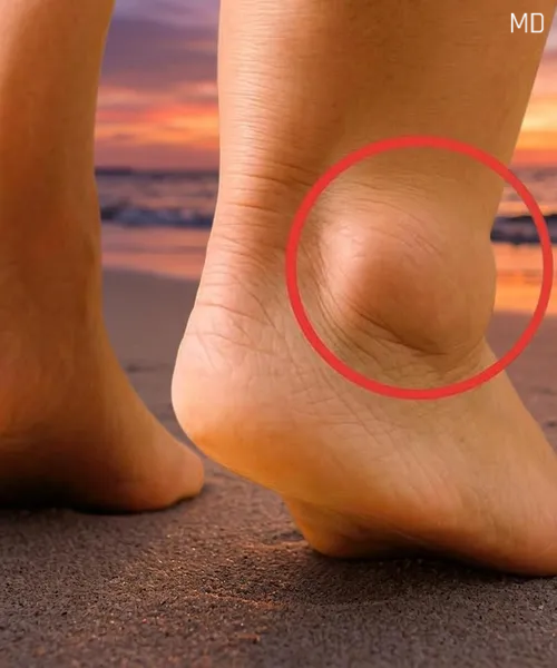 Understanding Swollen Feet in Older Adults: Causes and Simple Prevention Tips